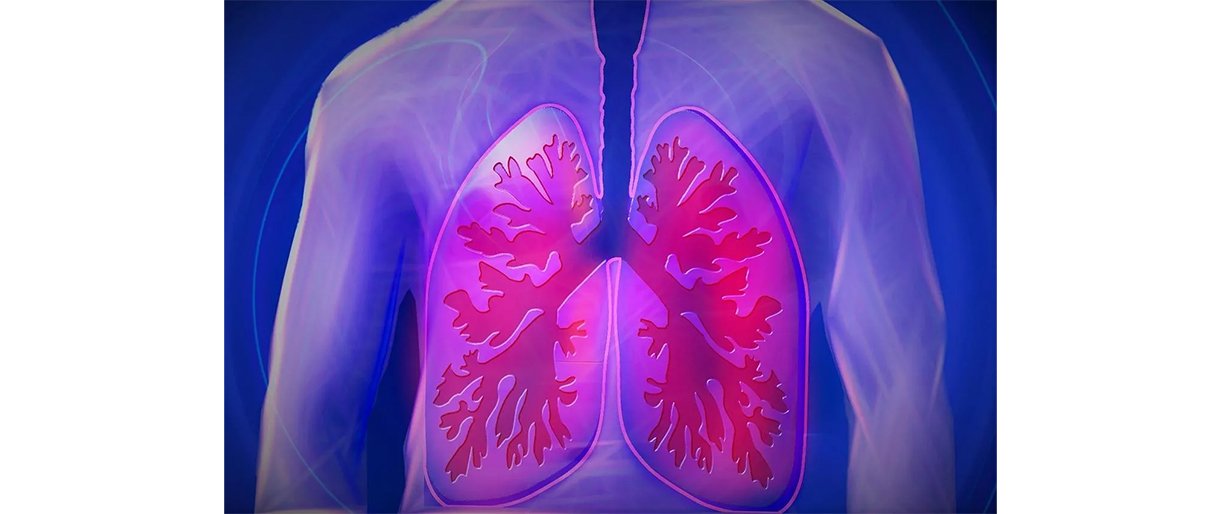 Plaučiai / www.needpix.com