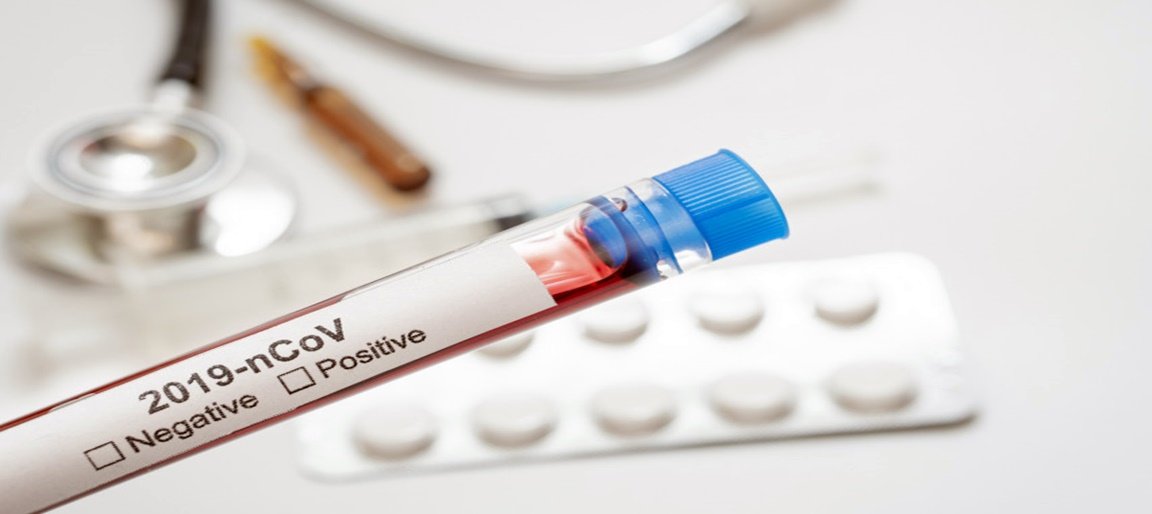 Patvirtinta dar 14 koronaviruso atvejų - viso jau 83