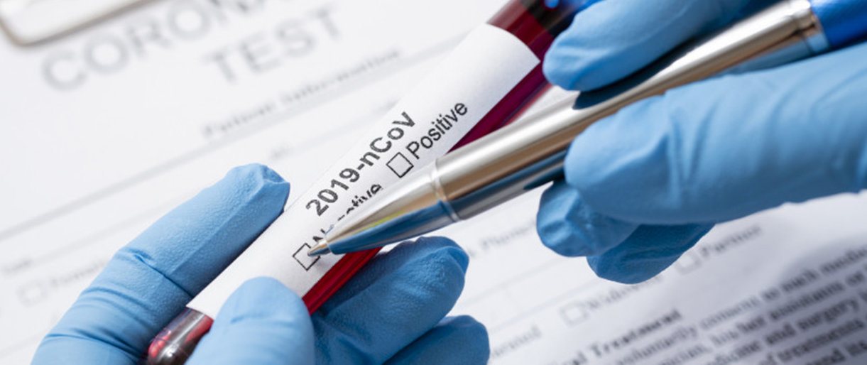 Lietuvoje patvirtinti 1399 koronaviruso infekcijos atvejai, naujų - 14, pasveikusiųjų - 594