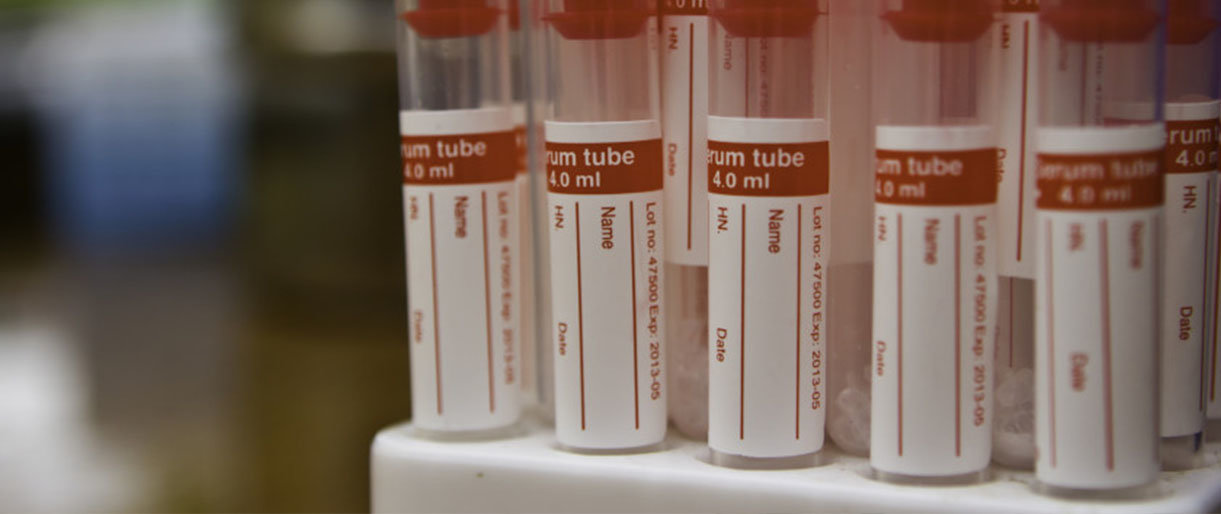 NKC: pacientams skubiai reikalingas kraujas, kviečiama padėti ekstremalioje situacijoje