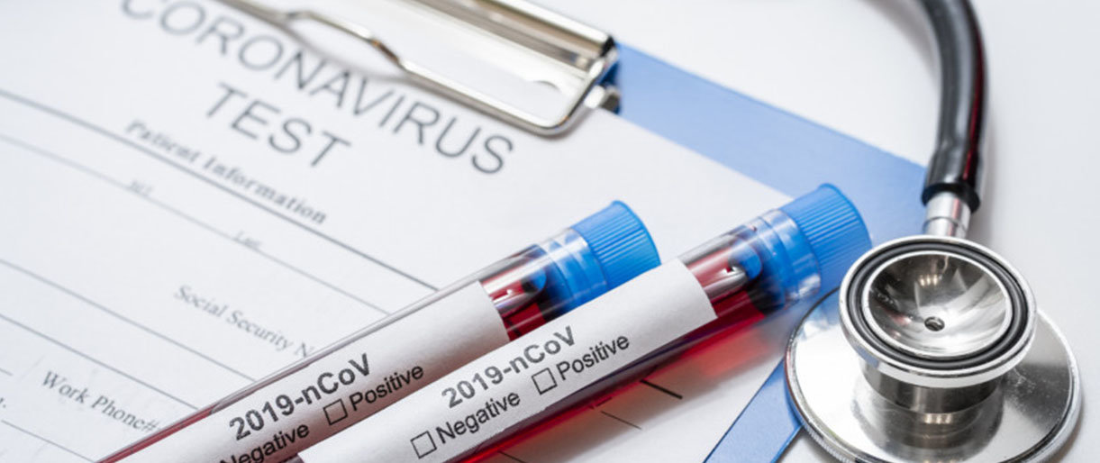 Mobiliuose punktuose tirtis bus galima tik esant būtinybei