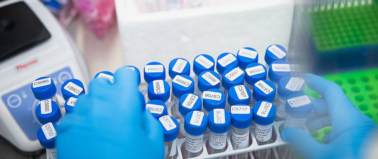 VU Gyvybės mokslų centro laboratorija / J. Stacevičiaus/LRT.lt nuotr.