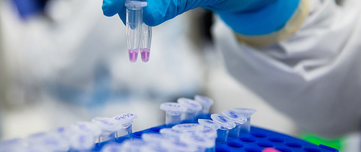 VU Gyvybės mokslų centro laboratorija / J. Stacevičiaus/LRT.lt nuotr.