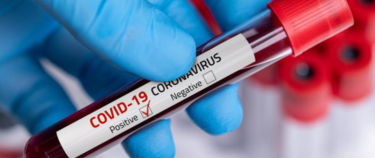 Lietuvoje nustatyti 3 nauji COVID-19 atvejai