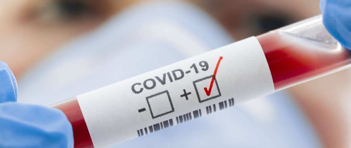 Lietuvoje per parą patvirtinti 3 nauji COVID-19 atvejai ir viena mirtis