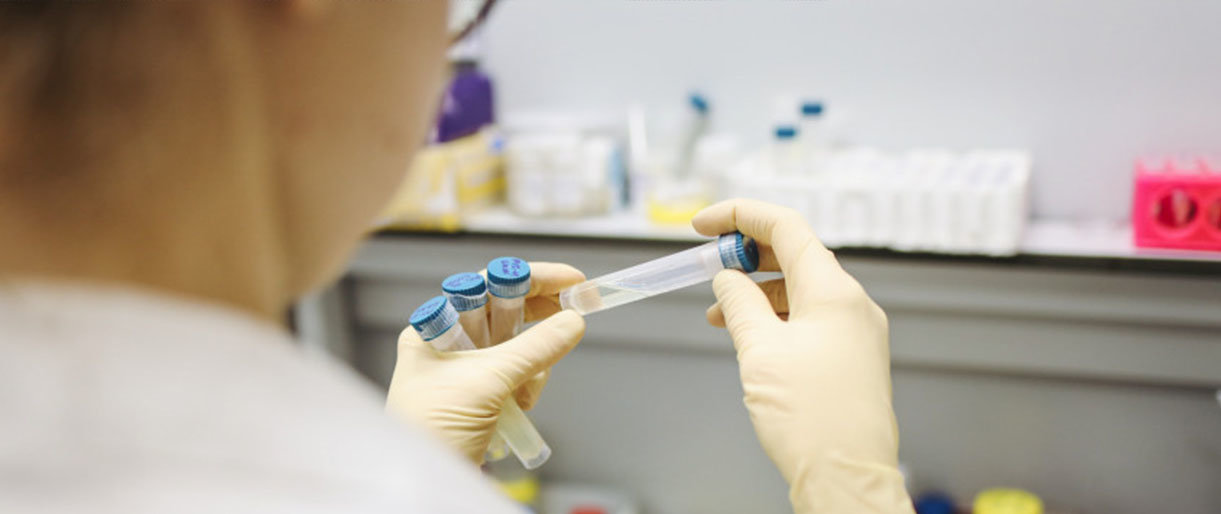 Vilniaus, Anykščių, Trakų ir Kretingos rajonuose bus intensyviau testuojama dėl koronaviruso