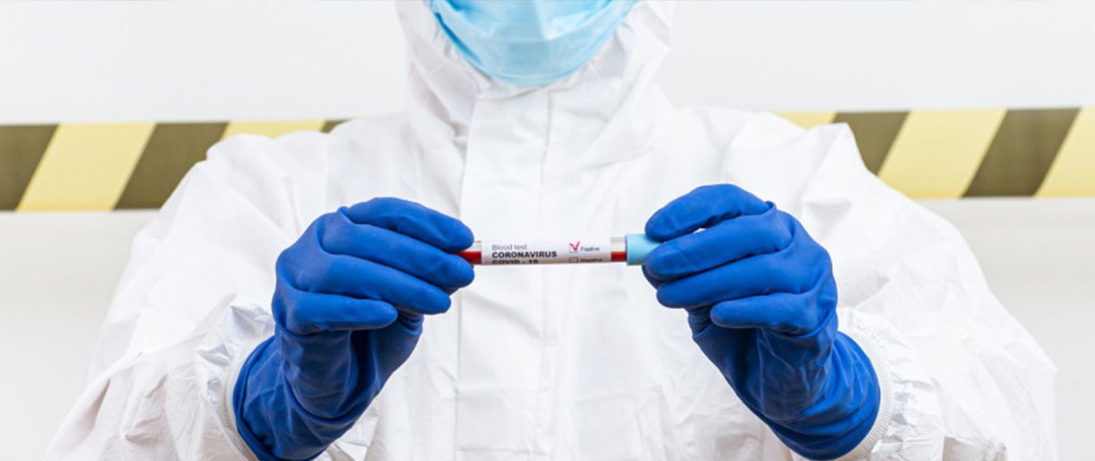 Per vakar Lietuvoje patvirtinti 9 nauji užsikrėtimo koronavirusu at... Per vakar Lietuvoje patvirtinti 9 nauji užsikrėtimo koronavirusu atvejai