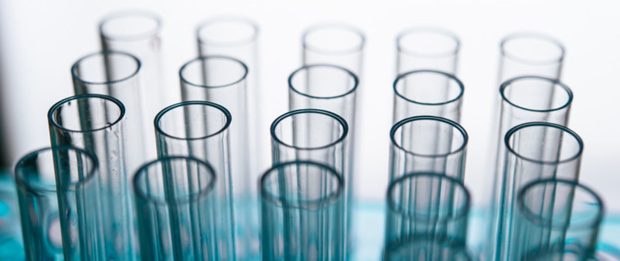 SAM: teigiamą COVID-19 tyrimo atsakymą gavę asmenys informuojami nedelsiant