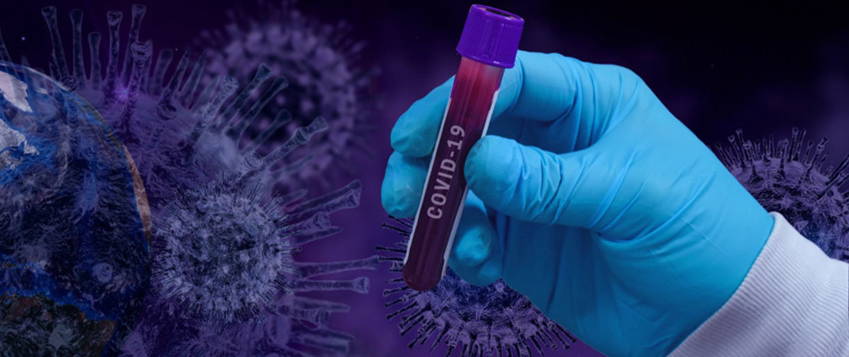 SAM skelbia atnaujintas rekomendacijas, kaip užkirsti kelią koronaviruso plitimui  