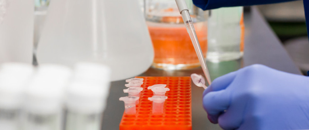 SAM: teigiamą greitojo testo rezultatą turi patvirtinti PGR testas...  SAM: teigiamą greitojo testo rezultatą turi patvirtinti PGR testas koronavirusui nustatyti