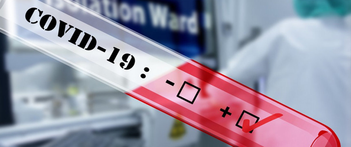 Lietuvoje užregistruoti 36 nauji koronaviruso atvejai