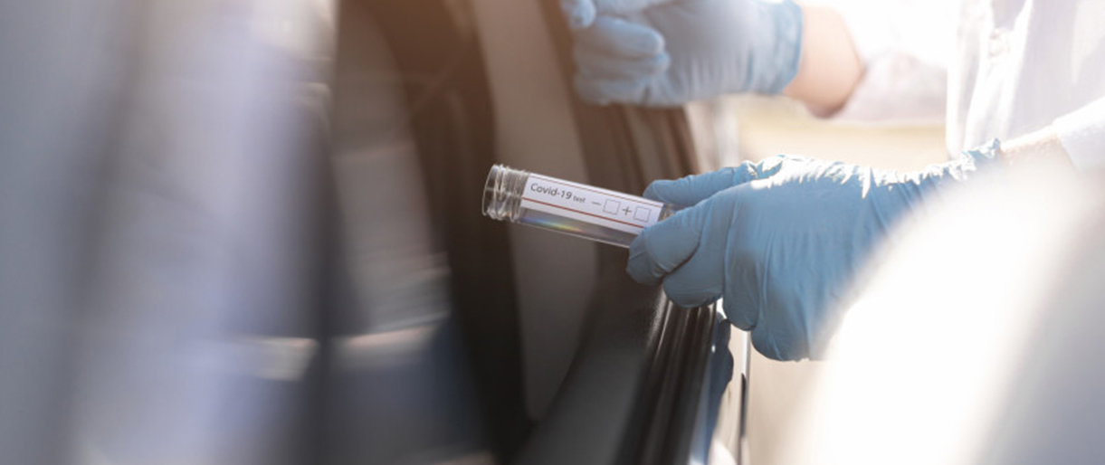 Lietuvoje patvirtinta 90 naujų koronaviruso atvejų