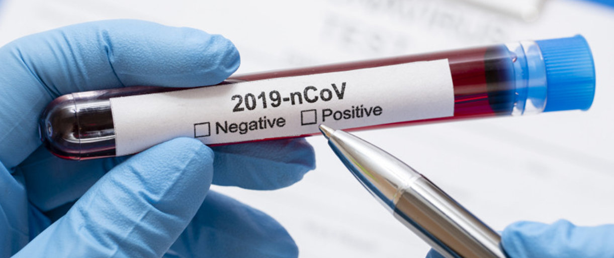 Lietuvoje patvirtinto 172 koronavirusinės infekcijos atvejai