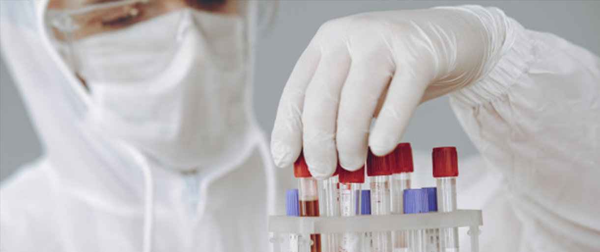 Nuo koronaviruso pandemijos pradžios jau ištirta virš milijono ėminių, sudaromos sutartys su naujais tiekėjais