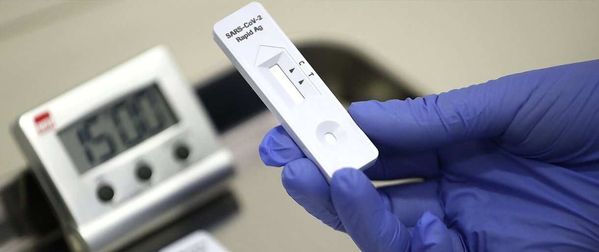 Šiandien Palangoje pradedamas testavimas greitaisiais antigeno testais